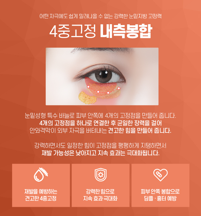 눈밑지방재배치, 수술에 대해 꼭 알아야 할 것 관련 이미지 7