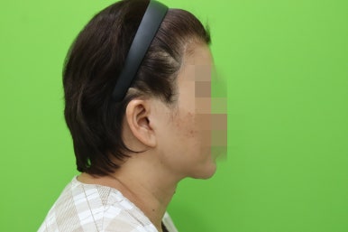 이중턱살, 설마 아직도 지방인줄 알고 계셨나요? 관련 이미지 8