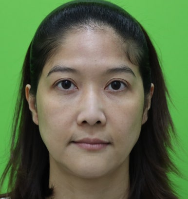 매부리코성형비용, 상담실장이 보면 싫어할 양심 선언 관련 이미지 5