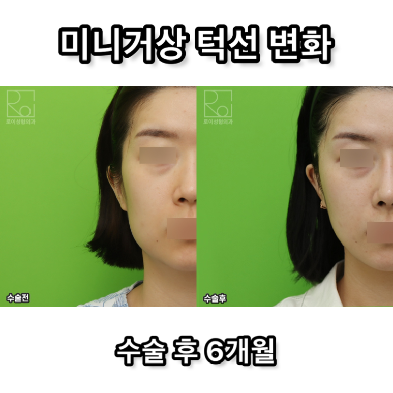 미니거상술, 효과없는 사람들의 공통점 관련 이미지 16
