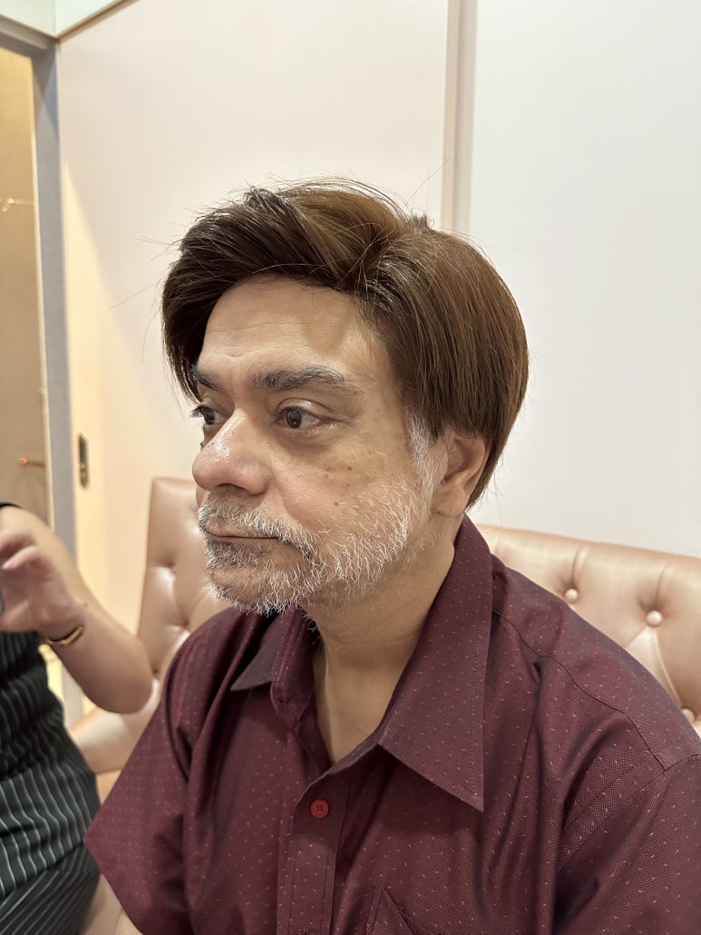 Facelift Review: Why the Neck Lift Technique Matters image 9