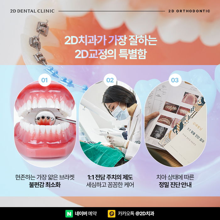 중학생치아교정 사춘기 걱정된다면 투디교정으로 신논현치과 관련 이미지 4