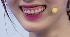 거미스마일 잇몸성형 강남라미네이트 2D치과 관련 이미지 9