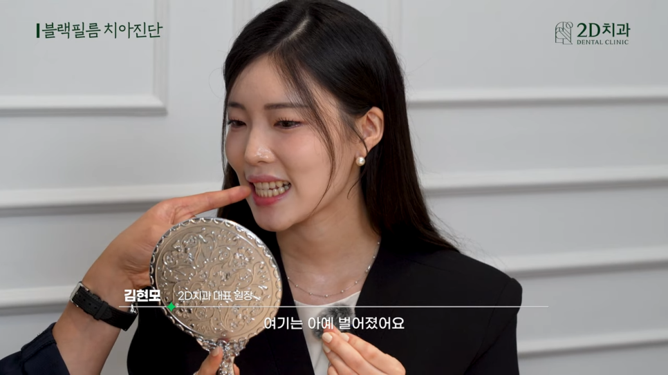 치과상담 앞니라미네이트 교정 치아에도 블랙필름 가능한가요? 관련 이미지 9