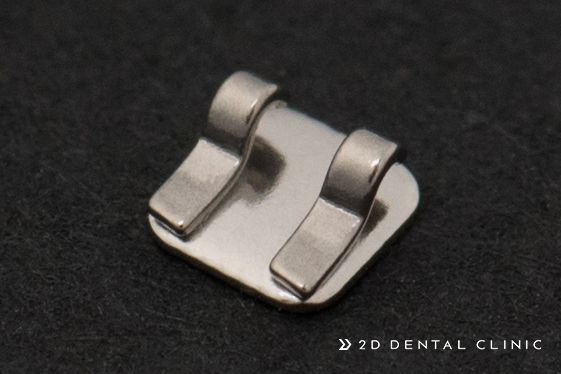 [투디(2D)치과] 2D치과의 2D교정이 특별한 이유! 관련 이미지 2