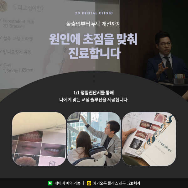 앞니치아교정, 2D교정은 관련 이미지 4