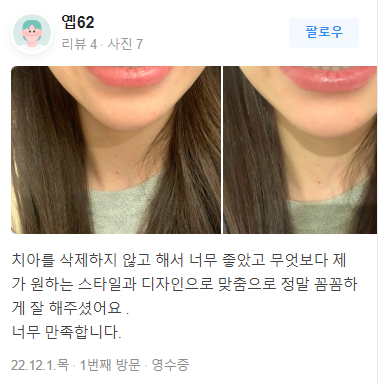 무삭제 라미네이트 비용 알아보기 ! 관련 이미지 5