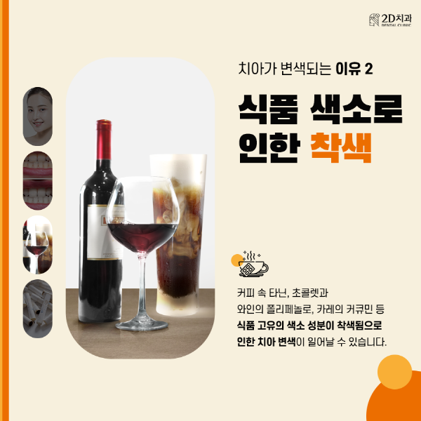 치아착색음식 때문? 양치해도 치아가 누런 이유 관련 이미지 3