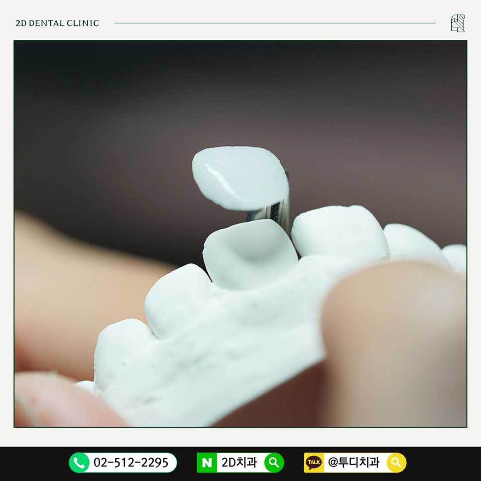 무삭제라미네이트는 어느 병원에서 해야할까요? 관련 이미지 3