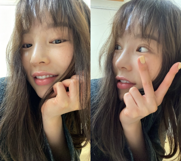 치아라미네이트 잘 하는 투디치과 관련 이미지 19