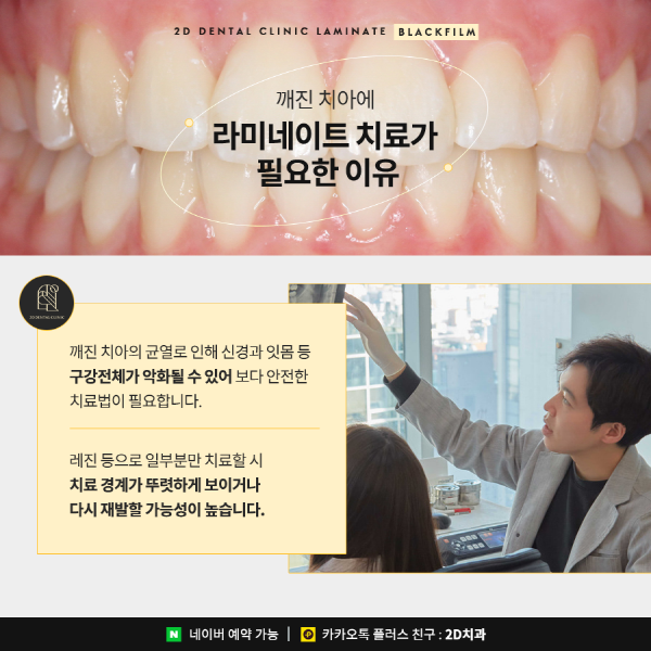 "깨진 앞니 방치하면 안 돼요!" 2D치과 맞춤 치료법 관련 이미지 3
