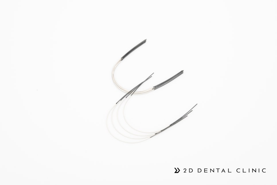 [투디(2D)치과] 치아교정에 화이트 와이어를 선택하는 이유? 관련 이미지 3