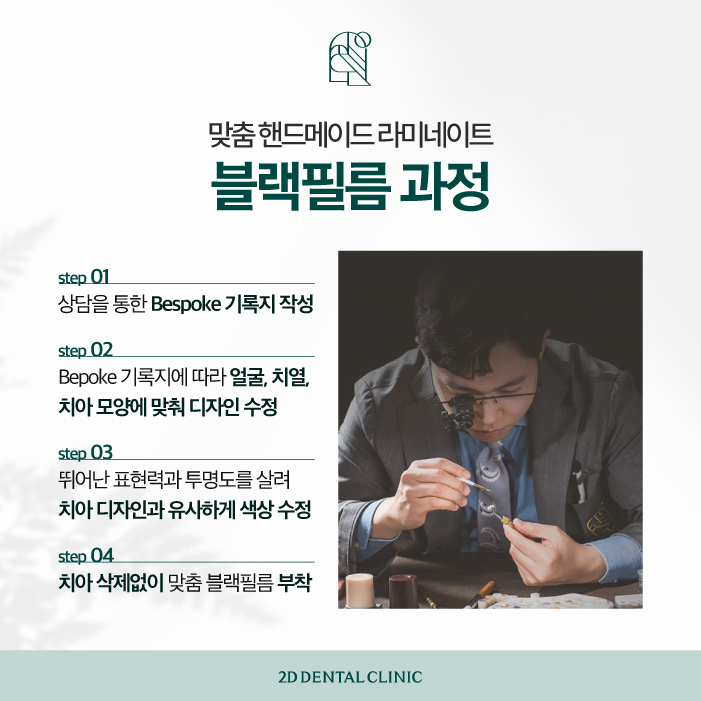 이 시림 없이 무삭제 라미네이트잘하는곳 관련 이미지 5