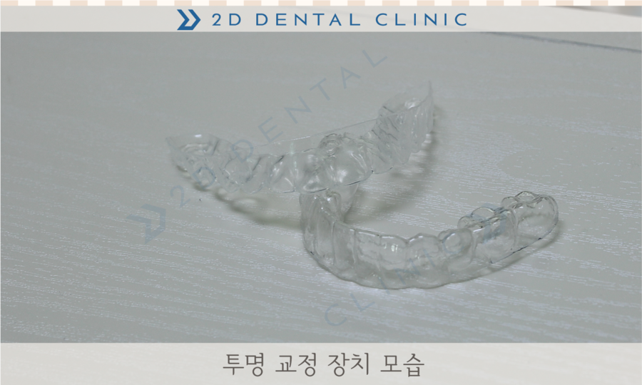 [교정상식] 설측교정,투명교정,콤비교정 장치종류 및 장단점! 관련 이미지 1