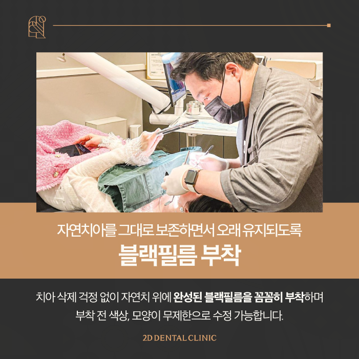 무삭제라미네이트후기 투디치과 블랙필름 탄생 과정 관련 이미지 7