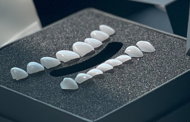 거미스마일 잇몸성형 강남라미네이트 2D치과 관련 이미지 6