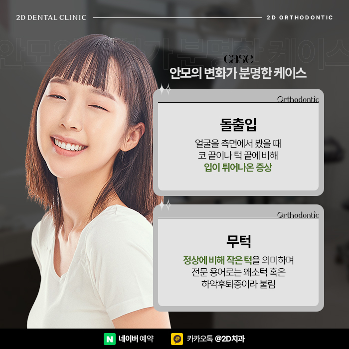 치아교정으로 얼굴형이 바뀔까? 돌출입, 무턱 교정치과 관련 이미지 4