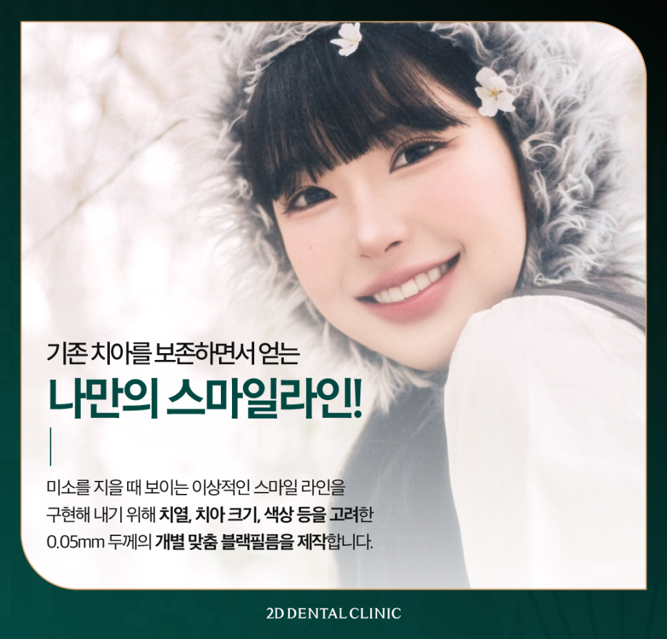 압구정치과 치아성형비용 무삭제 블랙필름 가격과 장점 관련 이미지 5