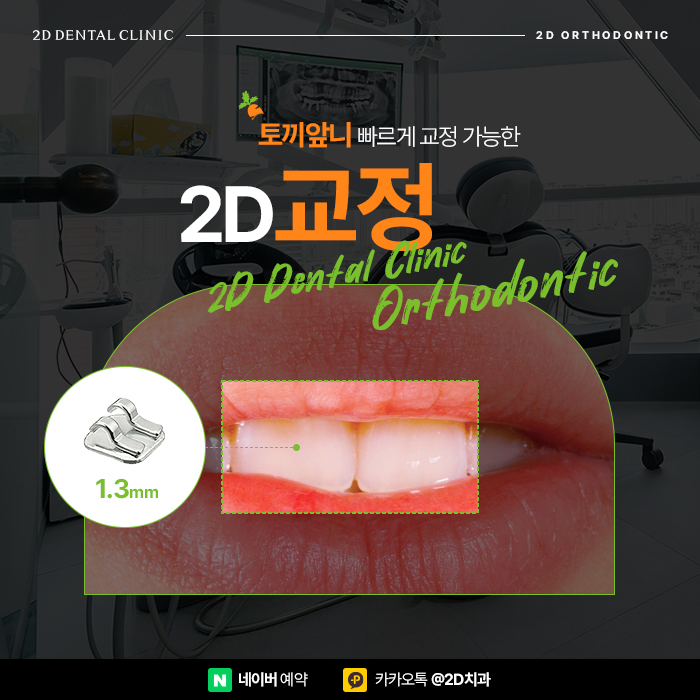 토끼앞니 강남역 2D교정으로 고르게 관련 이미지 1