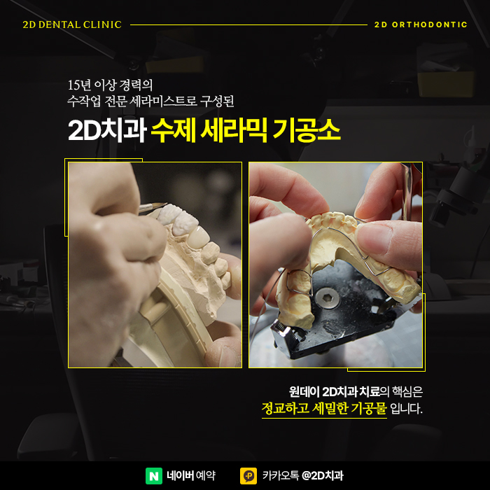 이빨 벌어짐 개선 앞니부분교정가격 비교하고 강남역 부분교정 관련 이미지 6