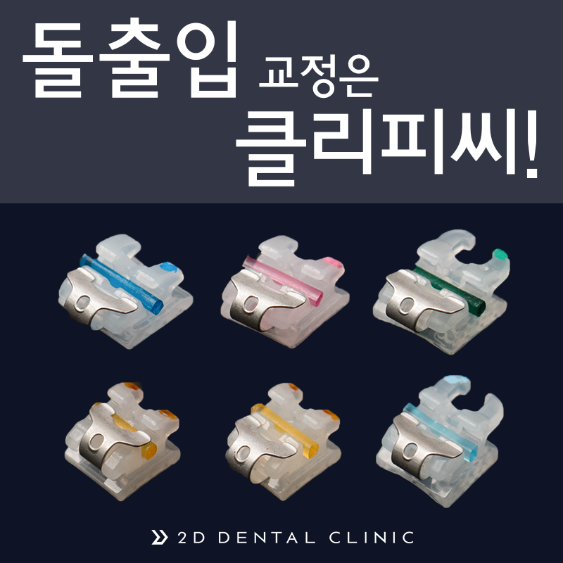 돌출입, 클리피씨로 교정기간과 통증을 최소화! 관련 이미지 2