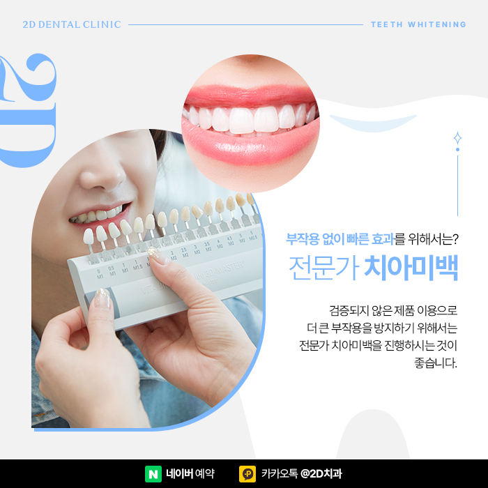 셀프치아미백의 단점, 전문가 치아미백으로 해결 위해서는 강남역 치과 관련 이미지 3