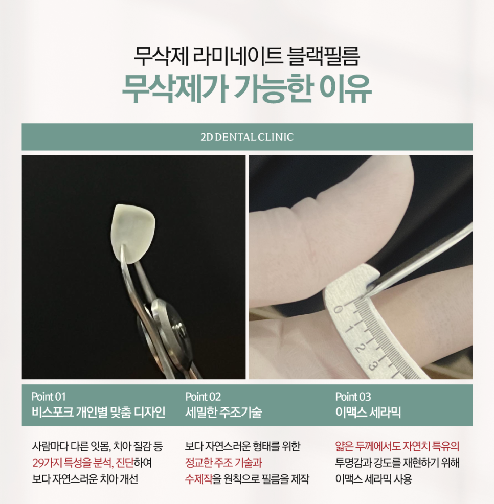 튼튼하면서도 자연스럽게, 치아무삭제라미네이트 앞니성형 관련 이미지 4