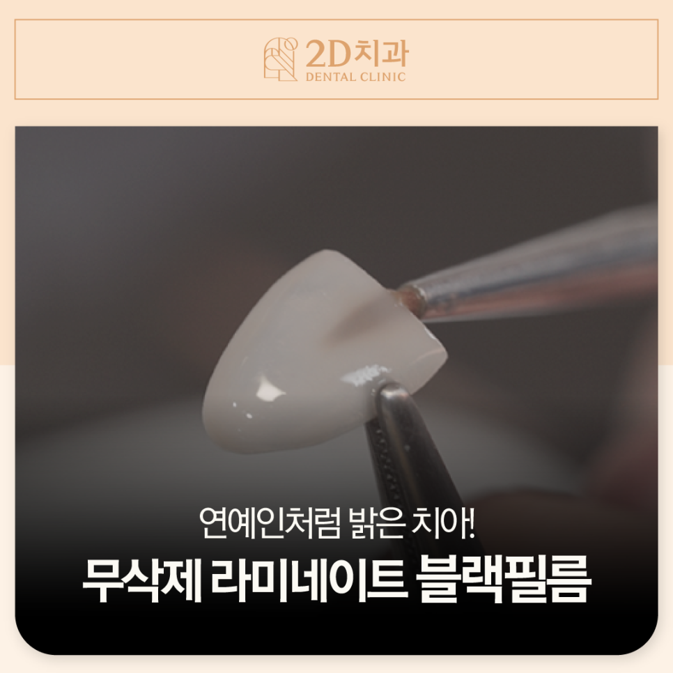 서초치과 치아변색치료 미백도 블랙필름으로 관련 이미지 1