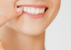 강남라미네이트 무삭제 치아성형 블랙필름 관련 이미지 2