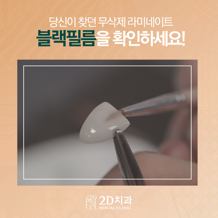 무삭제라미네이트 앞니성형 꼼꼼하게 진행하려면 관련 이미지 1