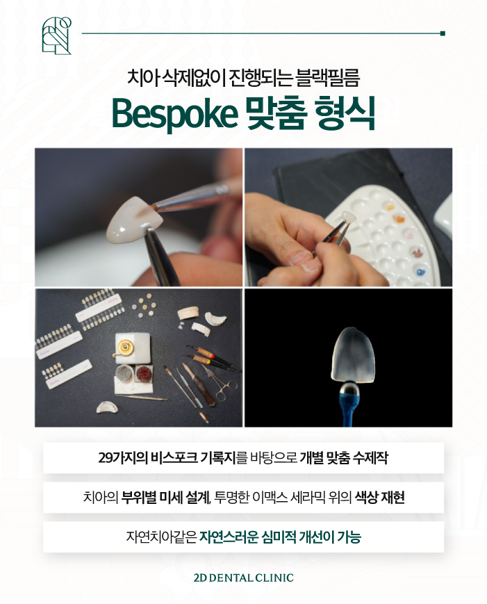 무삭제라미네이트 진행 과정이 궁금하신가요? 관련 이미지 5