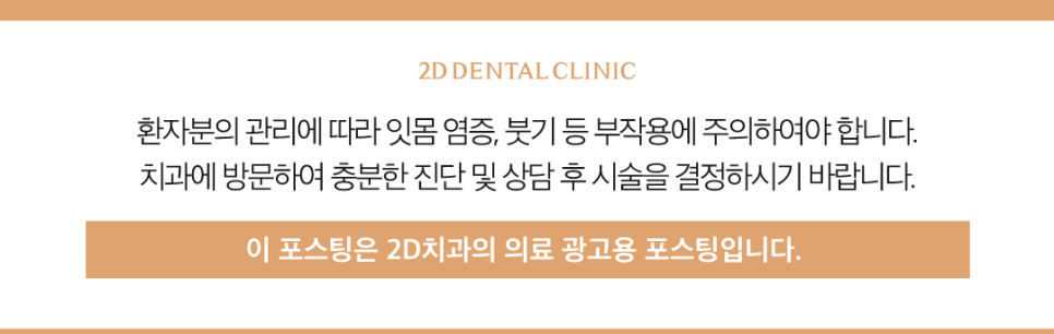무삭제라미네이트후기 벌어진치아 해결하는 블랙필름 관련 이미지 13
