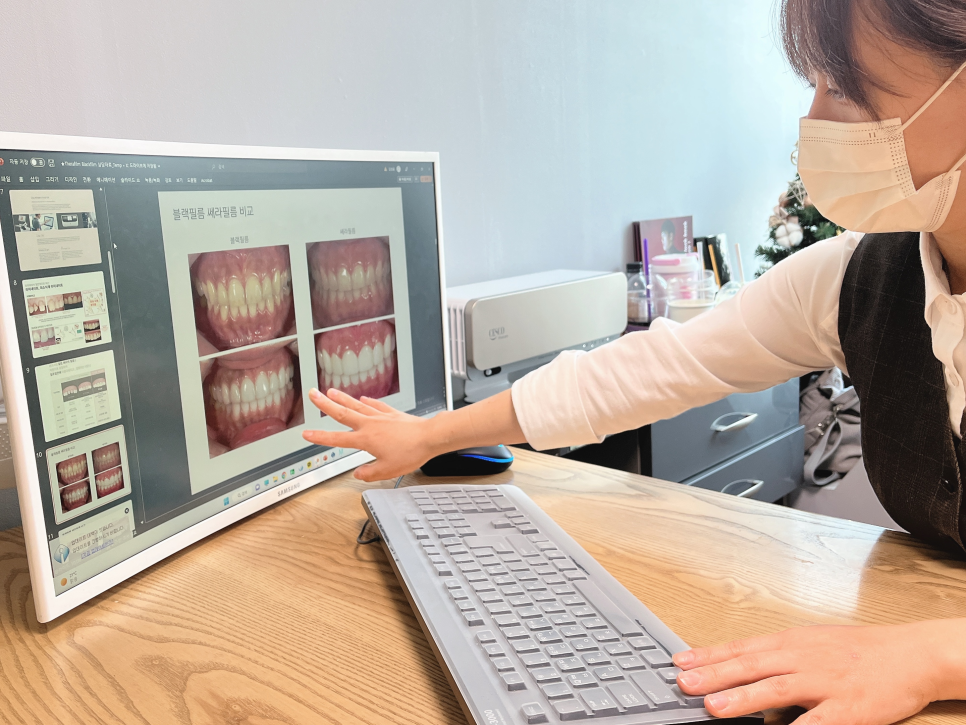 무삭제 치아블랙필름 치료과정 알아보기 관련 이미지 1