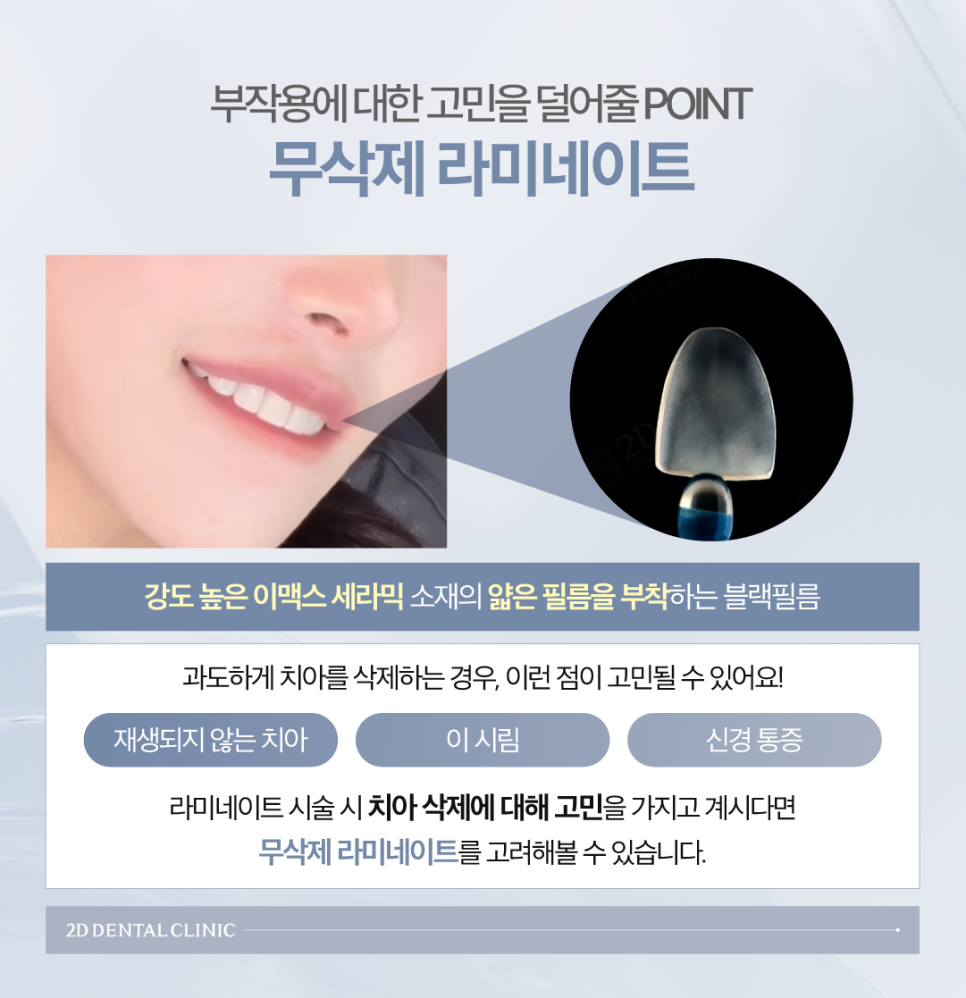 앞니라미네이트가격 다양한 요소를 꼼꼼하게 고려해야 합니다 관련 이미지 5