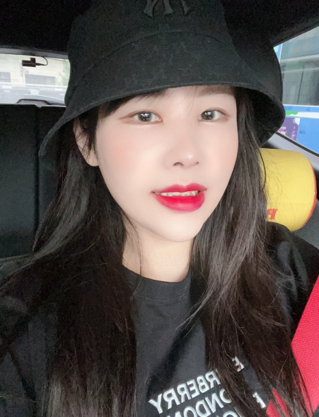 현직 2D 치과위생사가 시술한 무삭제 라미네이트 블랙필름 옥니개선 후기 관련 이미지 3