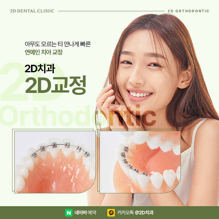 아무도 모르게 티 안나는 연예인교정으로 강남역 교정치과 관련 이미지 1