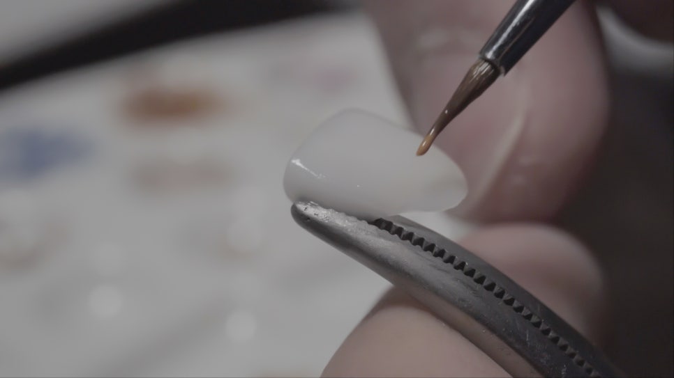 앞니깨짐, 치아미백엔 무삭제 "쎄라필름(TheraFilm)" 관련 이미지 12