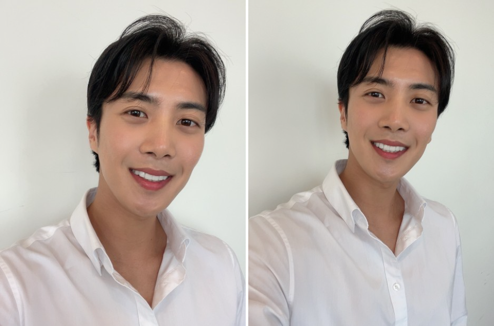 라미네이트치료 치아손상없는 무삭제라미네이트 블랙필름 관련 이미지 7