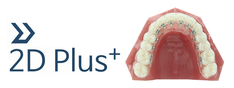 2D Plus+(플러스) 교정, 심한 케이스도 티 나지 않게! 관련 이미지 1