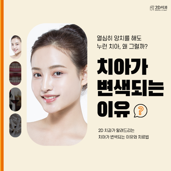 치아착색음식 때문? 양치해도 치아가 누런 이유 관련 이미지 1