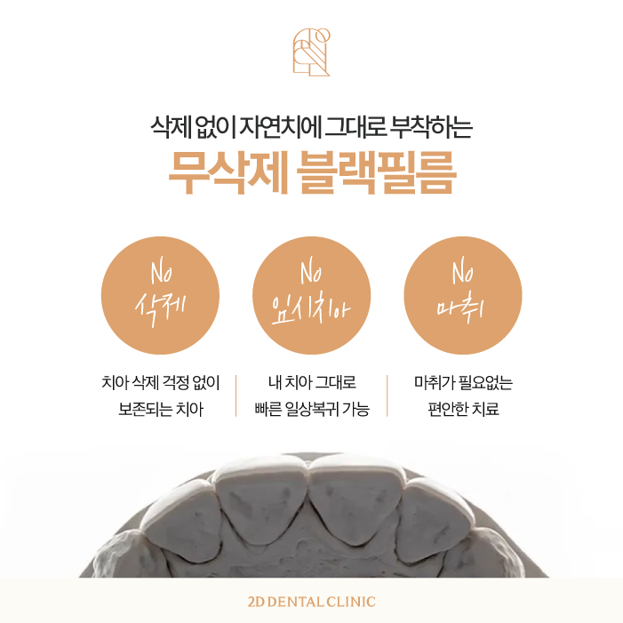 블랙필름 무삭제라미네이트가격 퀄리티 높은 이유 관련 이미지 4