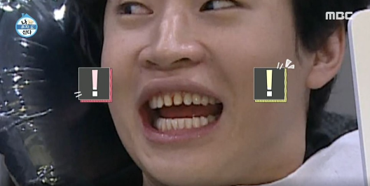 연예인라미네이트 치아삭제단점 보완한 치아삭제 없는 블랙필름 관련 이미지 2