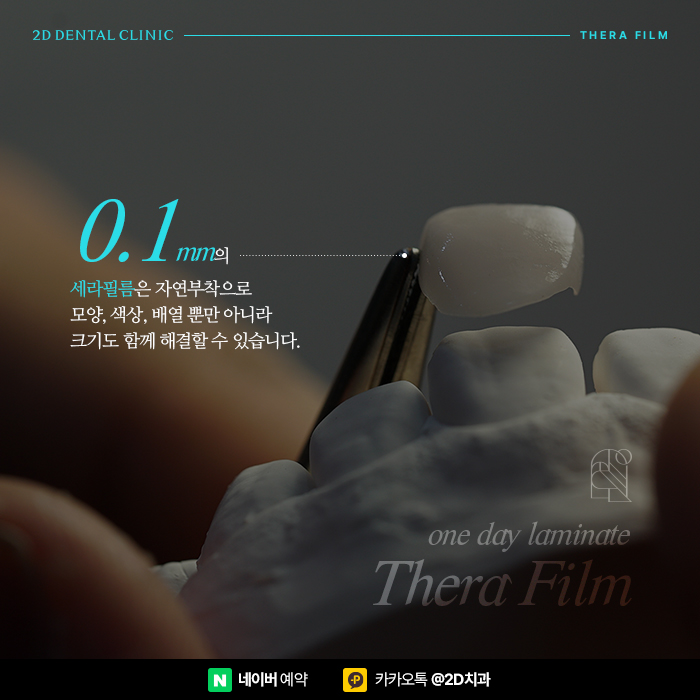 왜소치 세라필름, 원데이라미네이트로 해결하기 위해서는 강남역 치과 관련 이미지 4