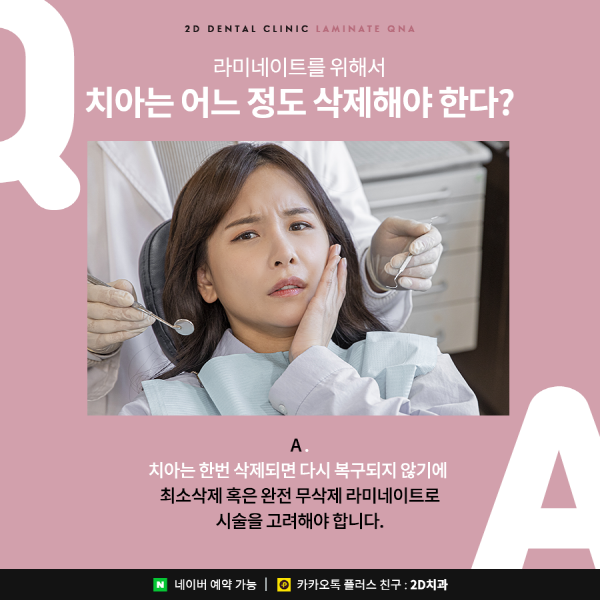 라미네이트 시술 전이라면? 이건 관련 이미지 3