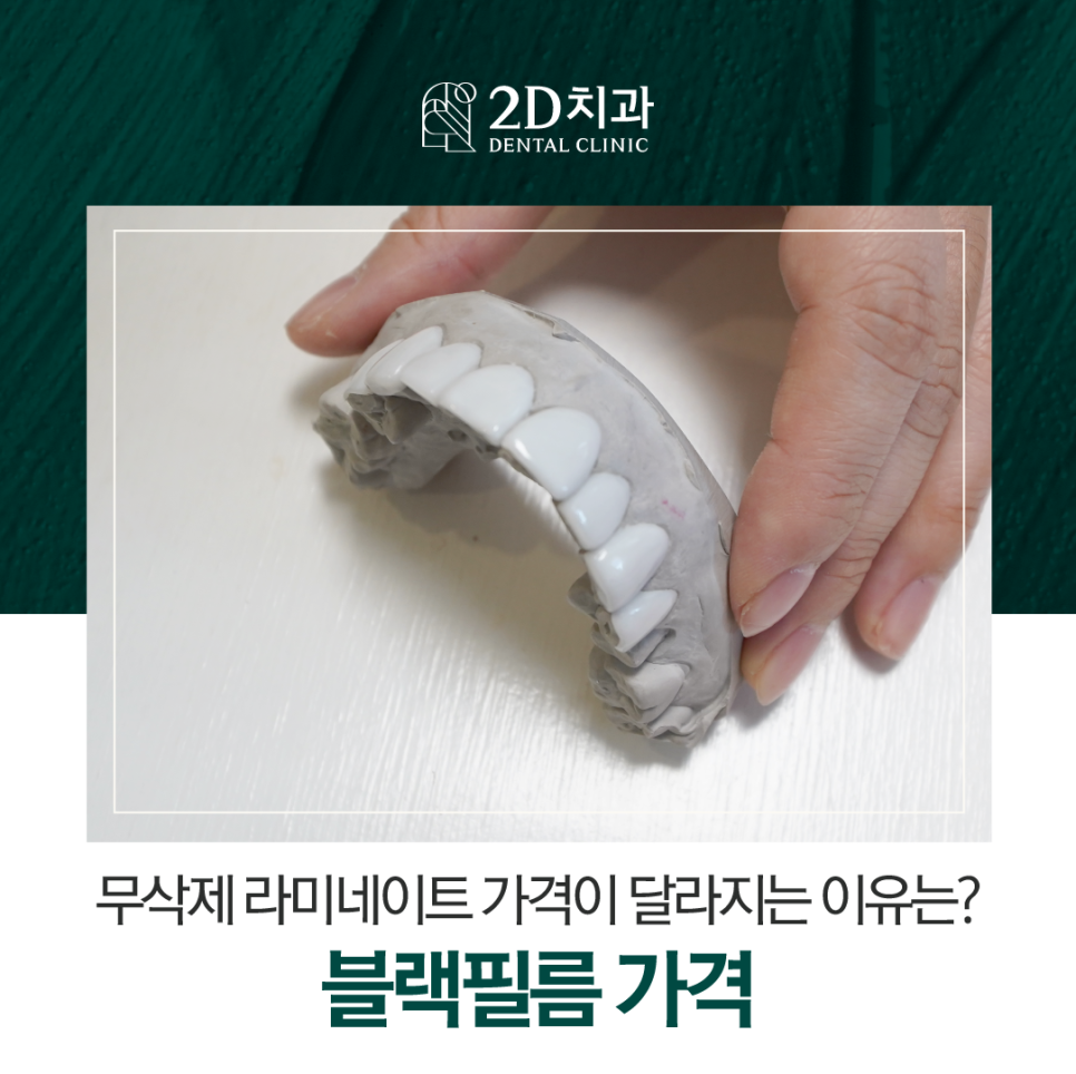 무삭제라미네이트가격 앞니변색도 개선 가능한 이유는? 관련 이미지 1
