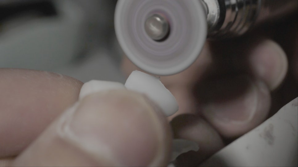 앞니깨짐, 치아미백엔 무삭제 "쎄라필름(TheraFilm)" 관련 이미지 11