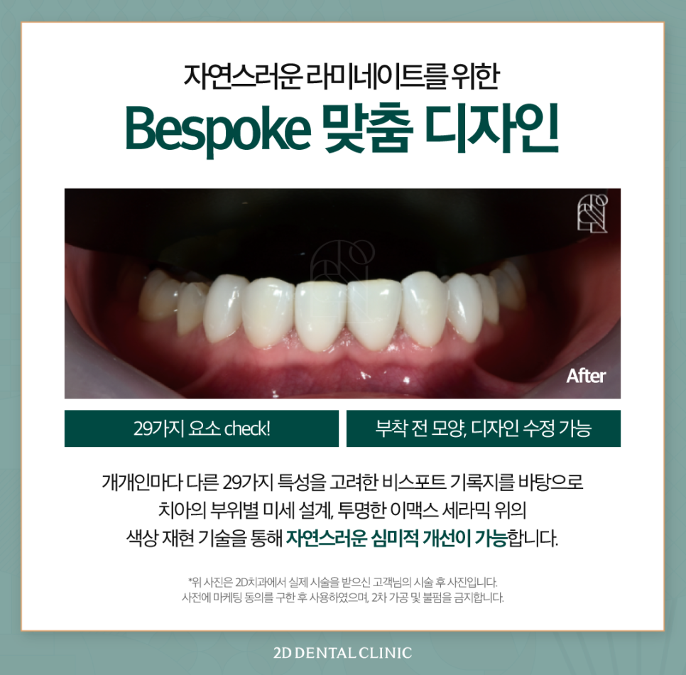 강남역치과 치아끝깨짐 첫인상을 좌우하는 요인! 관련 이미지 6