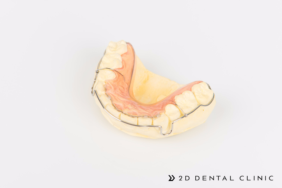 교정 유지 장치, 선택이 아닌 필수! 강남 2D치과 관련 이미지 8