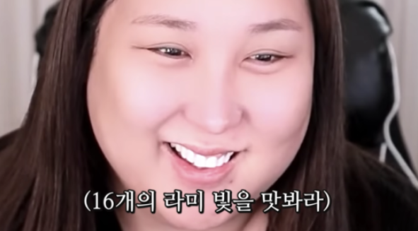 연예인라미네이트 균일하고 하얀치아를 원한다면 블랙필름 관련 이미지 2