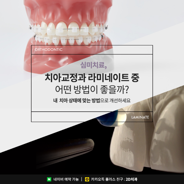 "치아 콤플렉스 극복" 치아 교정과 라미네이트중 뭐가 더 좋을까? 관련 이미지 1